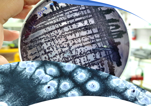 Foto portada Desarrollo de un colorante natural azul-violeta de origen microbiano con propiedades antimicrobianas obtenido a partir de un proceso sustentable y estandarizado como aditivo para la industria cosmética.